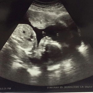 Mama Aidan profile icon