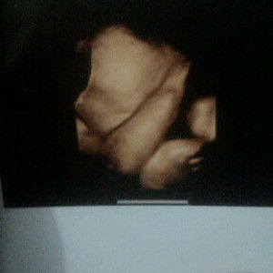 melisa anggraeni profile icon