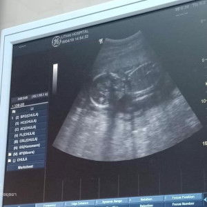 อุมาพร สุขภิมาน profile icon