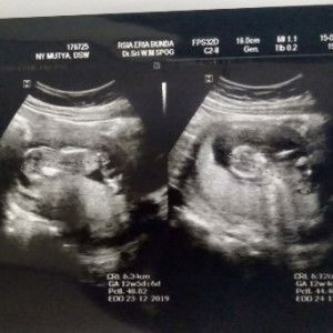 Si Kembar profile icon