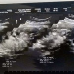 Si Kembar profile icon