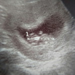 Fartin profile icon