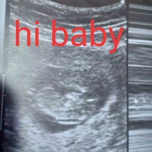 Llean Andres Capalad profile icon