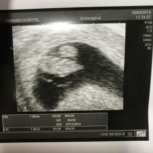 Navapat profile icon