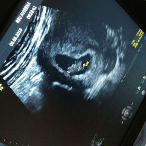 Lia Munawaroh profile icon