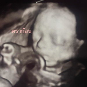 Hanny Loveyou profile icon