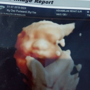 Dwi Purwanti Dwi profile icon