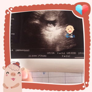 Aun Ontiwa profile icon