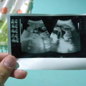 supaporn profile icon