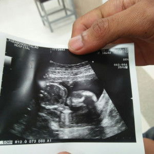 chontecha profile icon