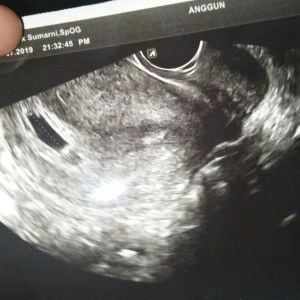 anditya profile icon