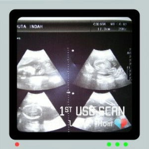 andyana rossa profile icon