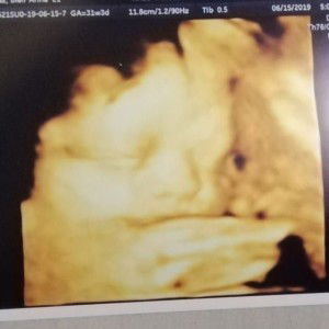 Bleir Lopez profile icon