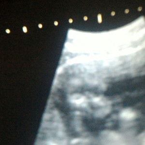 Nurul Anggraini profile icon