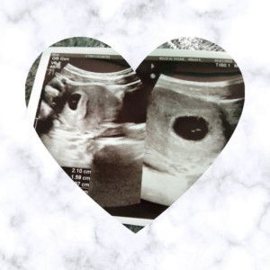 Risa Andiani profile icon