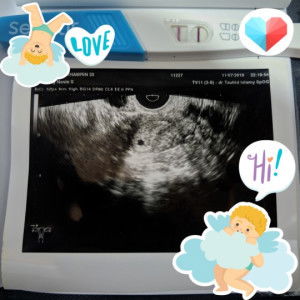 NOVIE SURYANINGTYAS profile icon