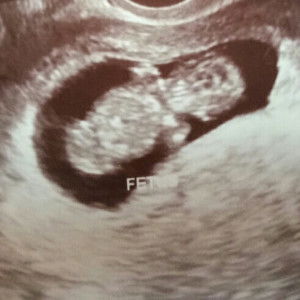 Alyssa Quitco profile icon