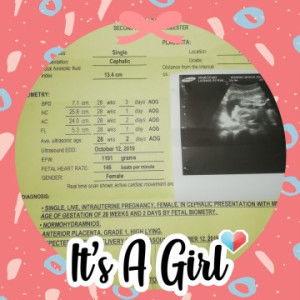 Lagman Bondoc Jhaylhyn Nhalyn profile icon