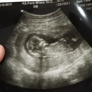 no name profile icon