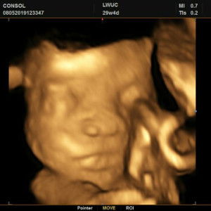 Carmella Joyce C. Querubin profile icon