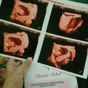 Angelina Febri Ayuningsari profile icon