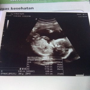 Isrofingah profile icon