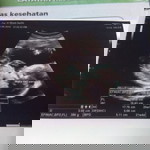 Isrofingah profile icon