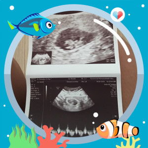 I.Pkaka profile icon