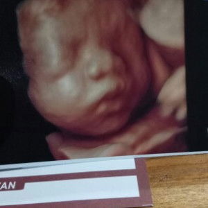 Shanty Hyun profile icon