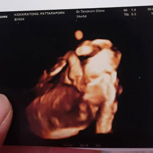 Pattaraporn Chosungnoen profile icon