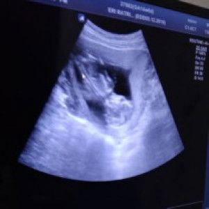 Eunice Ratri profile icon