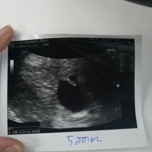 จิ๋ว profile icon