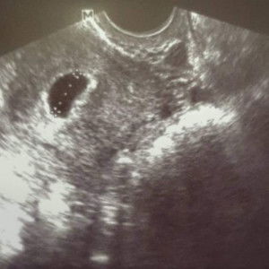 victoria profile icon