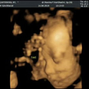 Oky Cahyaning Rahayu Sutoko profile icon