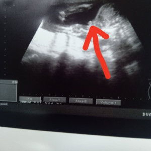 นนน profile icon