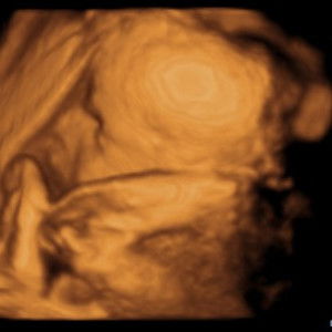 Devita Septiana profile icon