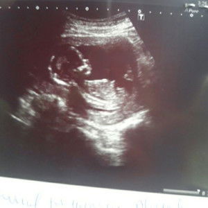 น้องหวาหว๋า profile icon