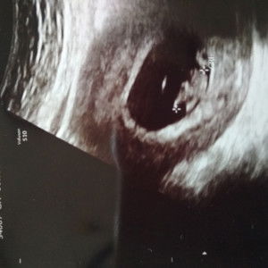 Meilina profile icon