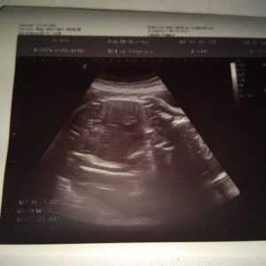 Angelyn Beatingo profile icon