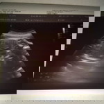 Angelyn Beatingo profile icon