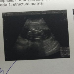 Pimpisa Tadsamran profile icon