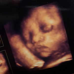 Izza Jalac-Bernal profile icon