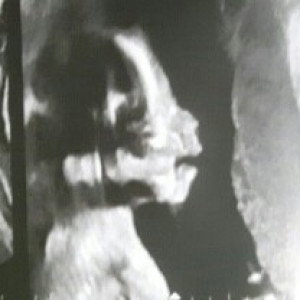 EvanKyerix profile icon