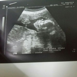 ชฎาภา profile icon