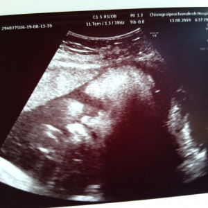 แม่มิ้นท์น้องมีเมลล์ profile icon