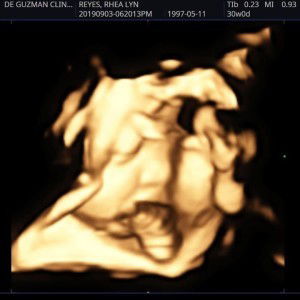 Rhea Lyn Mendoza Reyes profile icon