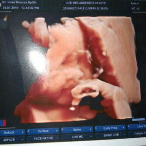 Lusy Melani profile icon