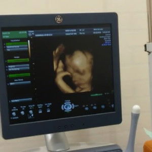 Suci Andayani profile icon