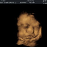 Icesel Ram Zara profile icon