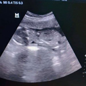 Dina Fitriyani profile icon